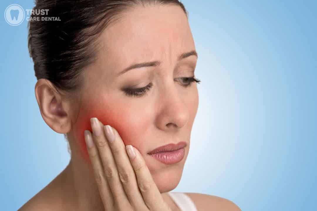 Pain-Management-After-Root-Canal