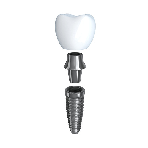 prosthodontics